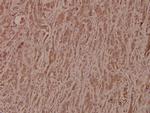 GSK3B Antibody in Immunohistochemistry (Paraffin) (IHC (P))