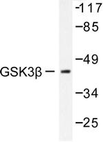 GSK3B Antibody in Western Blot (WB)