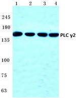 PLCG2 Antibody in Western Blot (WB)