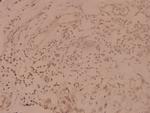 SHP-1 Antibody in Immunohistochemistry (Paraffin) (IHC (P))