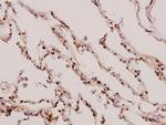 gamma Synuclein Antibody in Immunohistochemistry (Paraffin) (IHC (P))