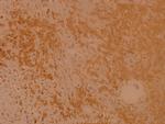 RSK1 Antibody in Immunohistochemistry (Paraffin) (IHC (P))