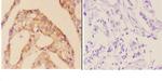 Cardiac Troponin I Antibody in Immunohistochemistry (Paraffin) (IHC (P))