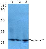 Cardiac Troponin I Antibody in Western Blot (WB)