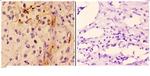 Cardiac Troponin I Antibody in Immunohistochemistry (Paraffin) (IHC (P))