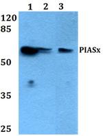 PIAS2 Antibody in Western Blot (WB)