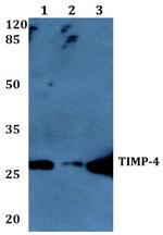 TIMP4 Antibody in Western Blot (WB)