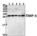 TIMP4 Antibody in Western Blot (WB)