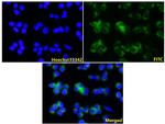 Tyrosinase Antibody in Immunocytochemistry (ICC/IF)