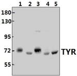 Tyrosinase Antibody in Western Blot (WB)