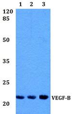 VEGFB Antibody in Western Blot (WB)