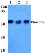 Vimentin Antibody in Western Blot (WB)