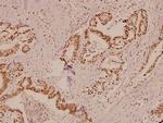 Protein APC Antibody in Immunohistochemistry (Paraffin) (IHC (P))