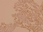 A-Raf Antibody in Immunohistochemistry (Paraffin) (IHC (P))