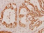 beta Arrestin 1 Antibody in Immunohistochemistry (Paraffin) (IHC (P))