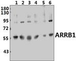 beta Arrestin 1 Antibody in Western Blot (WB)