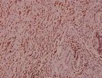 B-Raf Antibody in Immunohistochemistry (Paraffin) (IHC (P))