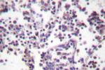 Caspase 3 Antibody in Immunohistochemistry (Paraffin) (IHC (P))