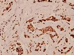 GP130 Antibody in Immunohistochemistry (Paraffin) (IHC (P))