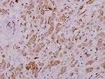 Cytokeratin 8 Antibody in Immunohistochemistry (Paraffin) (IHC (P))