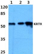 Cytokeratin 8 Antibody in Western Blot (WB)