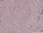 NCF4 Antibody in Immunohistochemistry (Paraffin) (IHC (P))