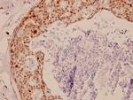 TK1 Antibody in Immunohistochemistry (Paraffin) (IHC (P))