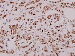 XIAP Antibody in Immunohistochemistry (Paraffin) (IHC (P))