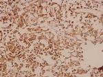 DDX3 Antibody in Immunohistochemistry (Paraffin) (IHC (P))