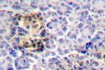 Moesin Antibody in Immunohistochemistry (Paraffin) (IHC (P))