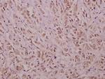 YAP1 Antibody in Immunohistochemistry (Paraffin) (IHC (P))