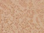 SHP2 Antibody in Immunohistochemistry (Paraffin) (IHC (P))