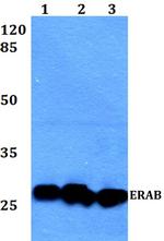 ERAB Antibody in Western Blot (WB)