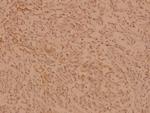 hnRNP C Antibody in Immunohistochemistry (Paraffin) (IHC (P))