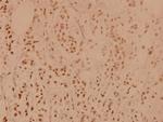 PP1 alpha Antibody in Immunohistochemistry (Paraffin) (IHC (P))