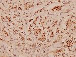 PDCD4 Antibody in Immunohistochemistry (Paraffin) (IHC (P))