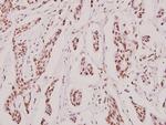 MRE11 Antibody in Immunohistochemistry (Paraffin) (IHC (P))