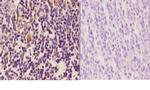 Vimentin Antibody in Immunohistochemistry (Paraffin) (IHC (P))