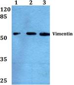 Vimentin Antibody in Western Blot (WB)