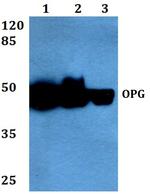 TNFRSF11B Antibody in Western Blot (WB)