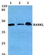 CD254 (RANK Ligand) Antibody in Western Blot (WB)