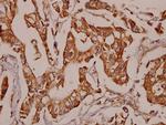 TNFR2 Antibody in Immunohistochemistry (Paraffin) (IHC (P))