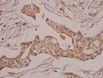 GRK2 Antibody in Immunohistochemistry (Paraffin) (IHC (P))