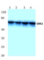 GRK2 Antibody in Western Blot (WB)