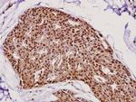 FEN1 Antibody in Immunohistochemistry (Paraffin) (IHC (P))