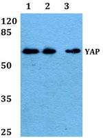 YAP1 Antibody in Western Blot (WB)