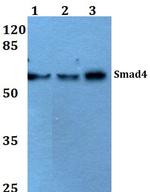 SMAD4 Antibody in Western Blot (WB)