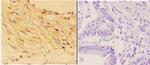 14-3-3 sigma Antibody in Immunohistochemistry (Paraffin) (IHC (P))