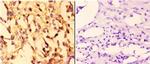 14-3-3 sigma Antibody in Immunohistochemistry (Paraffin) (IHC (P))