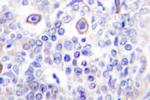 CD83 Antibody in Immunohistochemistry (Paraffin) (IHC (P))